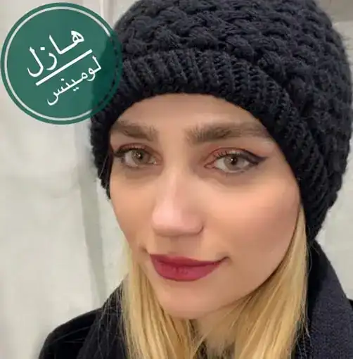 لنز رنگی عسلی لومینس هازل - Image 2