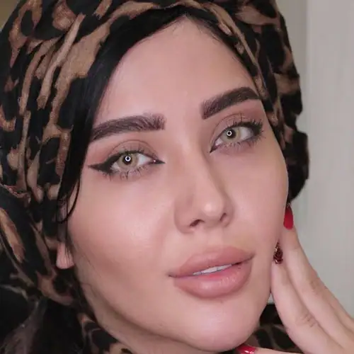خرید لنز رنگی عسلی ترسا گلد آی