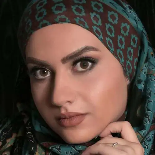 خرید لنز رنگی عسلی آرین براون تن1