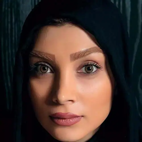 خرید لنز رنگی عسلی آرین براون تن2