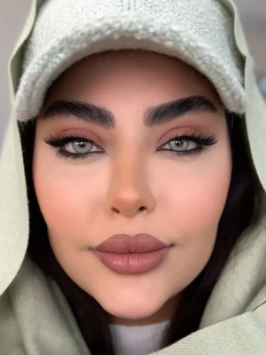 لنز رنگی طبی آیس کالر آلوورا