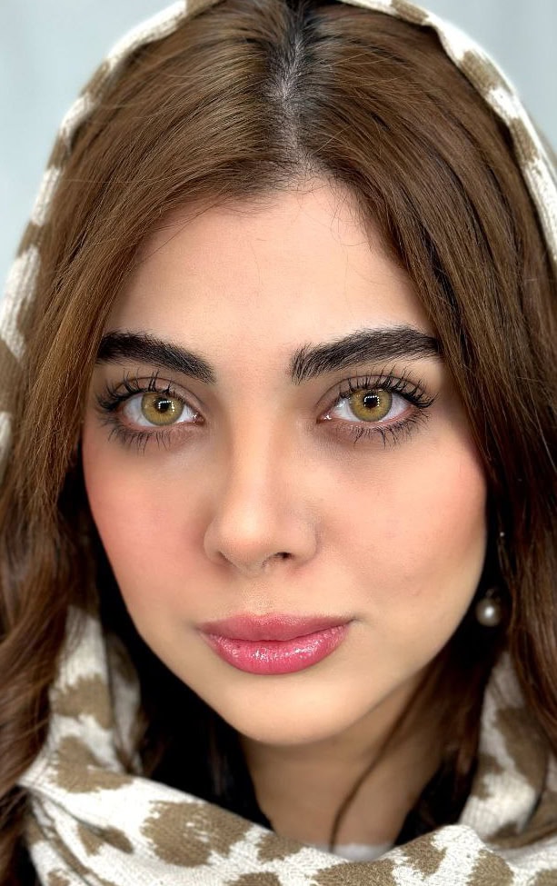 لنز رنگی عسلی یونیک کارامل - Image 7