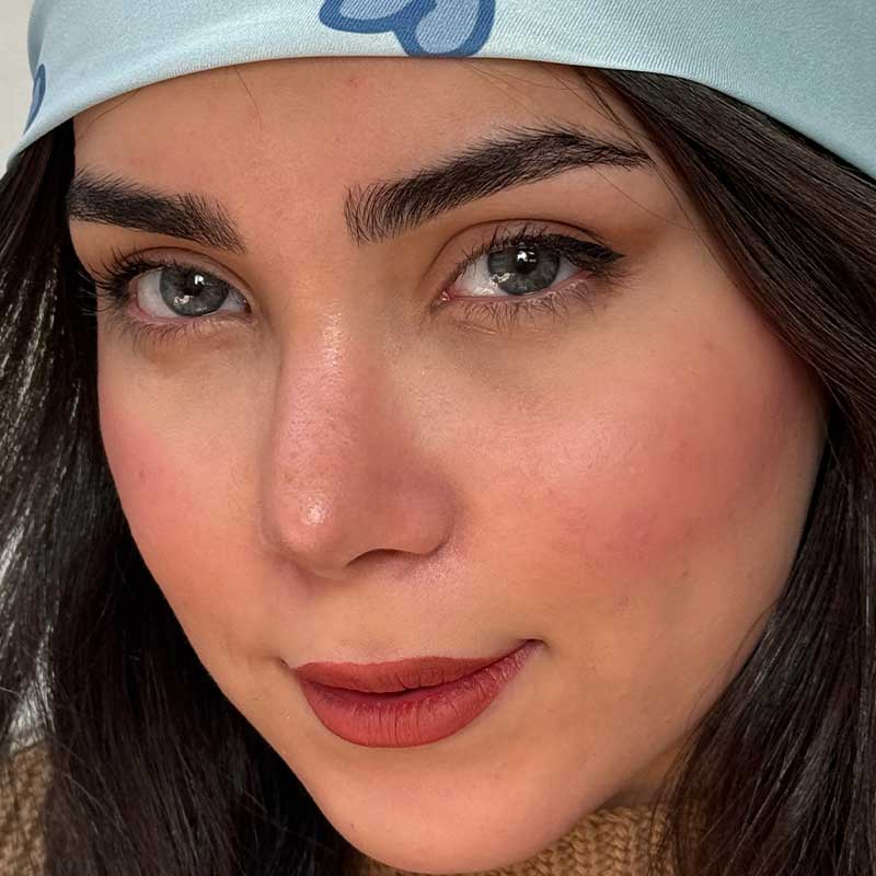 لنز رنگی آبی رز آلیس بلو - Image 3