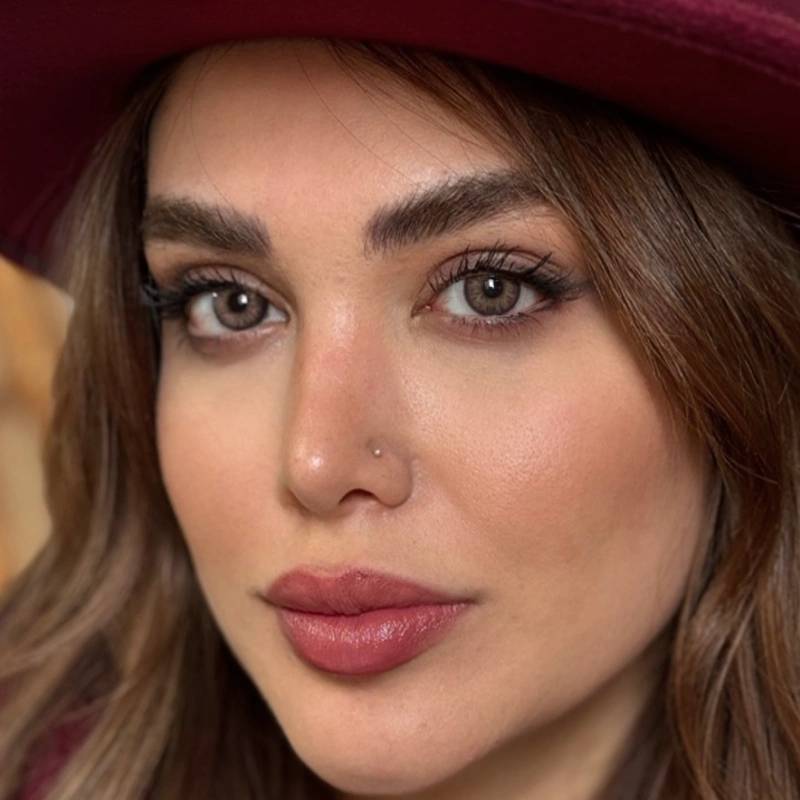 لنز رنگی عسلی رز آلیس براون